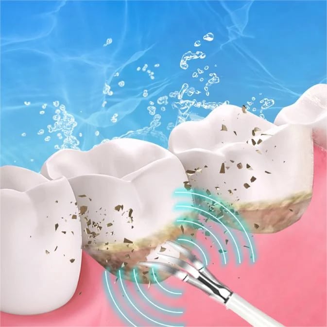 👨⚕Electric tooth cleaning instrument